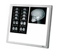 NEGATOSCOPIO EXTRAPLANO 21X30  (NDR)